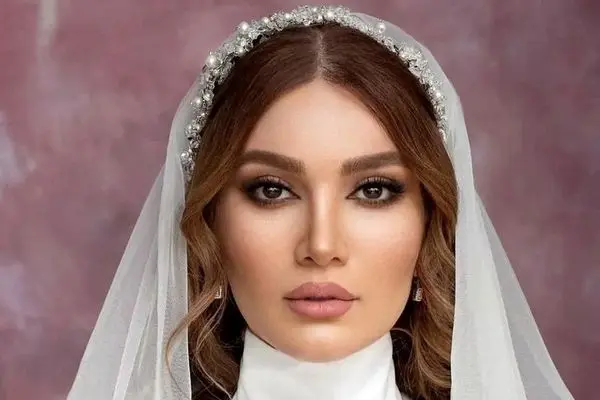 تغییرات چهره متین ستوده قبل و بعد از طلاق / با کامران جوانتر و خوشگلتر شد !