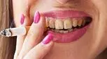 چند راهکار برای سفیدشدن دندان‌های زرد سیگاری‌ها!