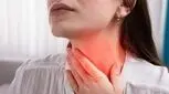 گرفتگی صدا فقط نشانه سرماخوردگی نیست/ شاید پای تیروئید در میان باشد