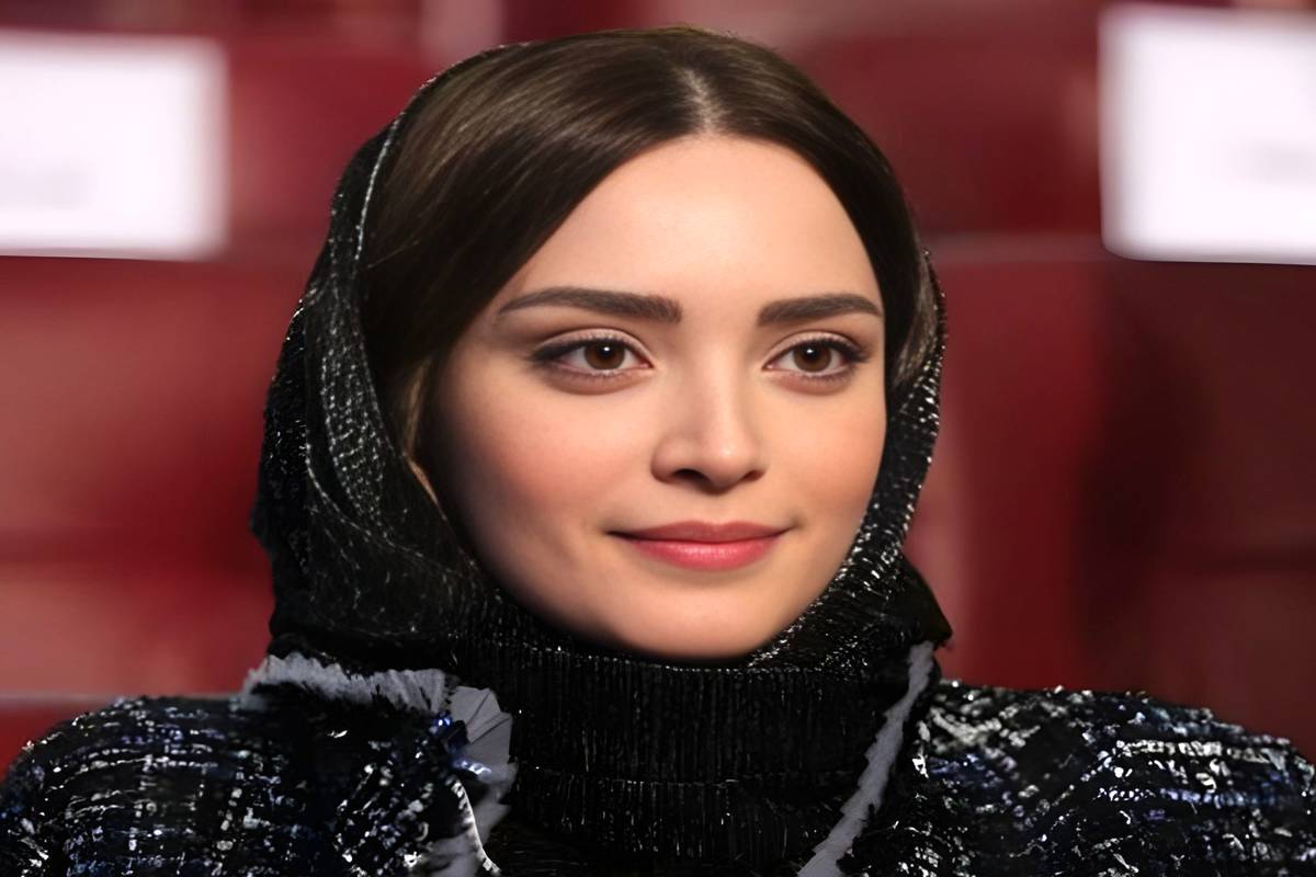 بهنوش طباطبایی چند عمل زیبایی انجام داده است؟ (تصاویر)