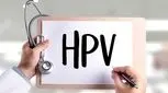 درمان hpv