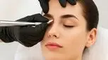 ۱۱ تفاوت فیبروز ابرو و میکروبلیدینگ + جدول مقایسه قیمتی
