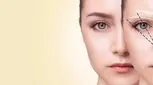 ابروهای ریخته را چگونه برمی‌گردانیم؟