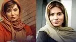 چهره نگار فروزنده قبل از عمل جراحی زیبایی باورکردنی نیست! (عکس)