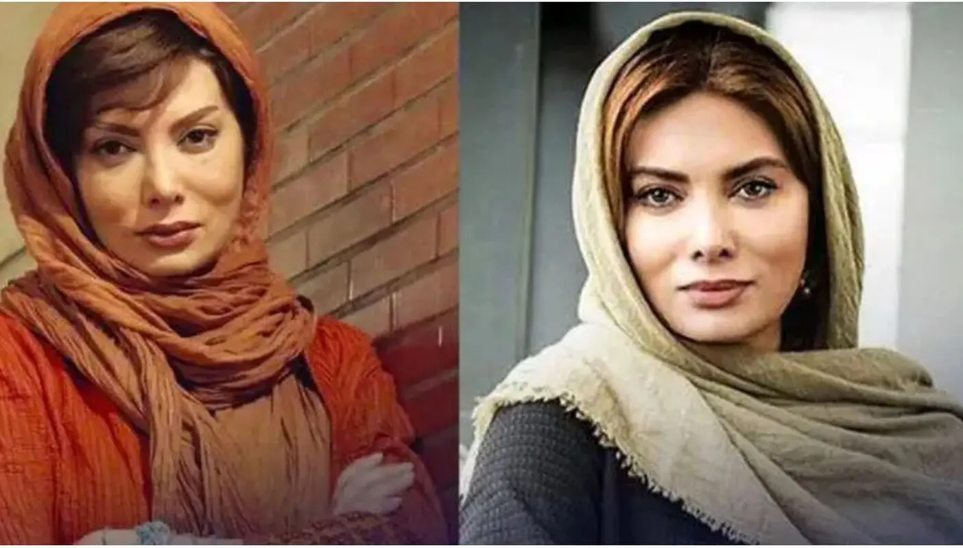 چهره نگار فروزنده قبل از عمل جراحی زیبایی باورکردنی نیست! (عکس)