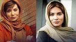 چهره نگار فروزنده قبل از عمل جراحی زیبایی باورکردنی نیست! (عکس)