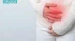اندومتریوز چیست و چگونه درمان می‌شود؟ | ۷ نشانه مهم + بهترین روش‌های درمان