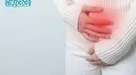 اندومتریوز چیست و چگونه درمان می‌شود؟ | ۷ نشانه مهم + بهترین روش‌های درمان