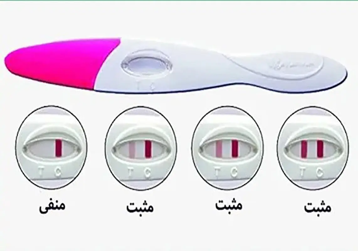 چند روز بعد از ivf بیبی چک مثبت میشود؟