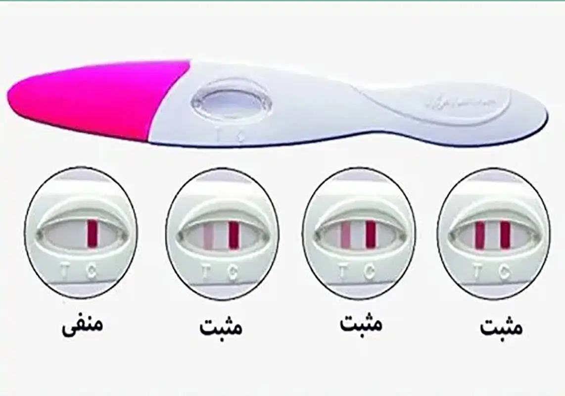 چند روز بعد از ivf بی‌بی چک مثبت میشود؟