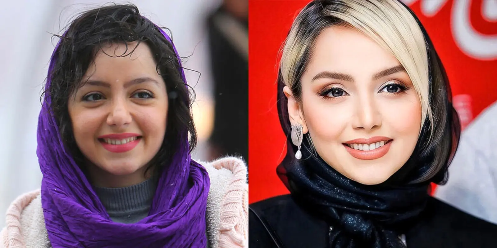 لیست عمل های زیبایی نازنین بیاتی لو رفت! (تصاویر)