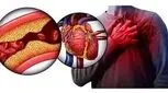 وقتی کلسترول در رگ‌های قلب رسوب می‌کند/ بیماری CAD را جدی بگیرید 

