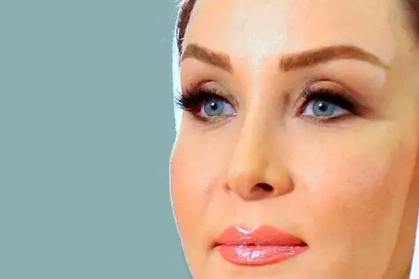 حدیث فولادوند با تغییر چهره جدید؛ بازیگری که دیگر شبیه گذشته نیست