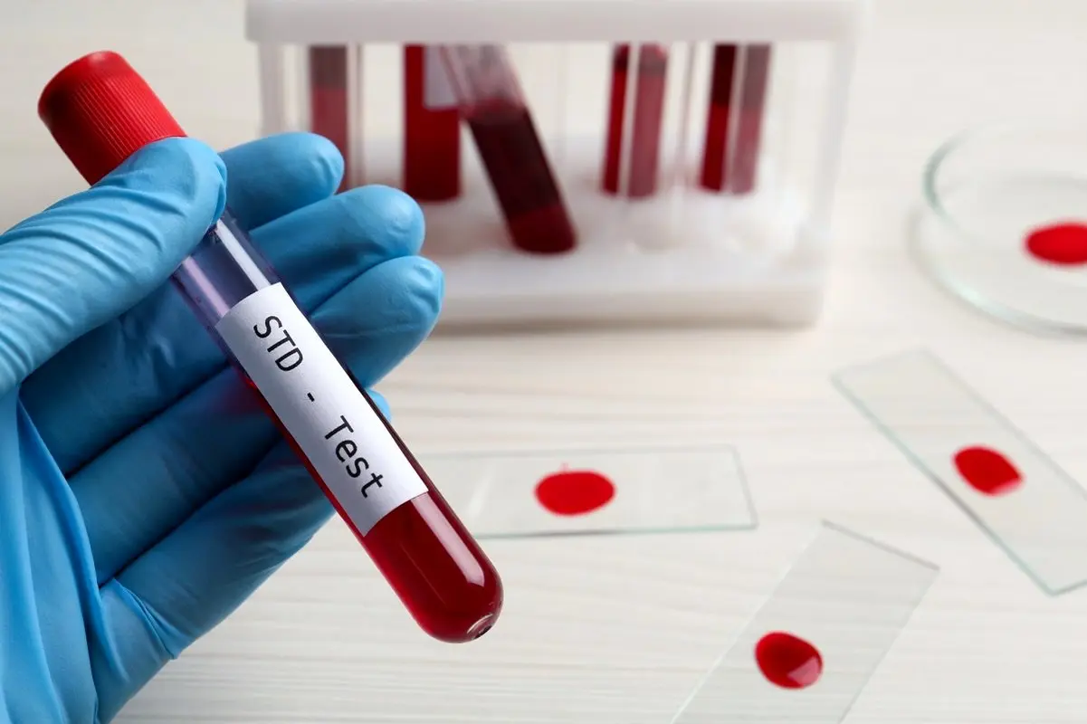 تست STD و نوع درمان آن