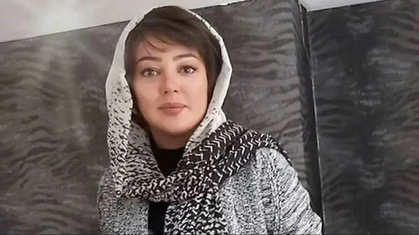 راز چهره واقعی رزیتا غفاری قبل از جراحی‌های زیبایی