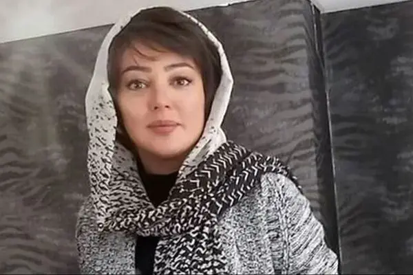 راز چهره واقعی رزیتا غفاری قبل از جراحیهای زیبایی