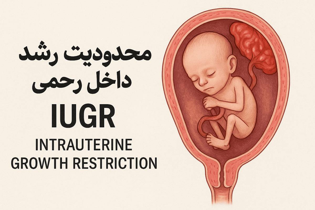 محدودیت رشد داخل رحمی IUGR چیست؟ دلایل، راه‌های پیشگیری و درمان آن