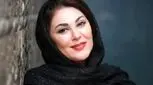 زیبایی خیره کننده لاله اسکندری در دوران نوجوانی / بدون عمل هم خوشگله !