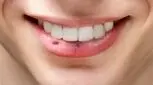 شخصیت شناسی جالب از روی خال صورت و بدن