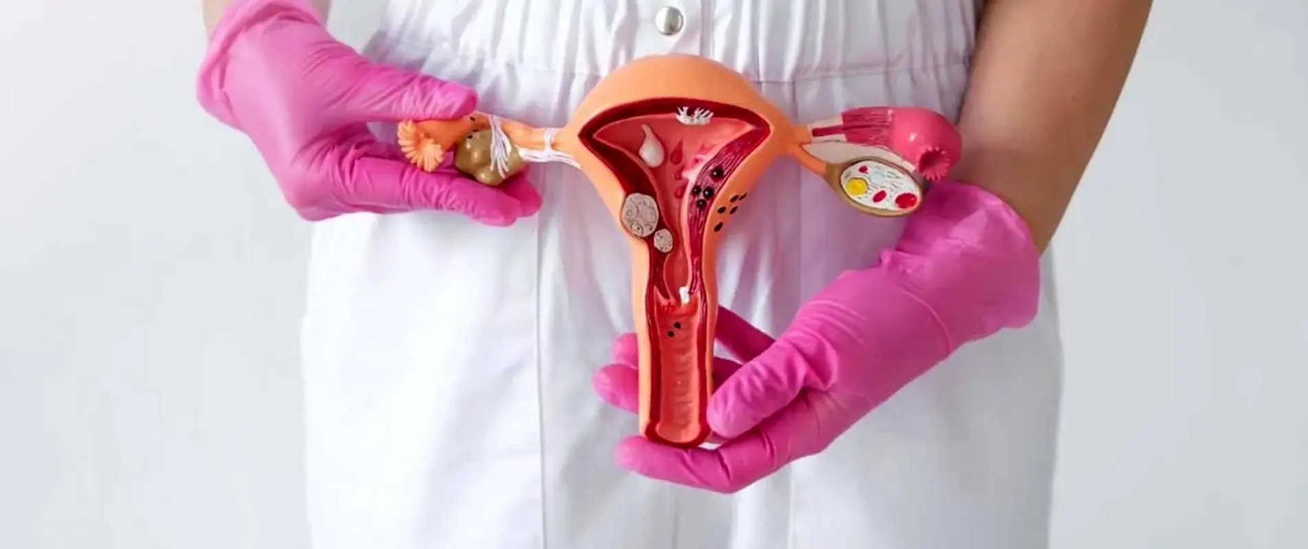 رحم و تخمدان کوچک، راهکار حل مشکل چیست؟