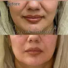 جوانساز هیبریدی نسل چهارم یا نخ مایع