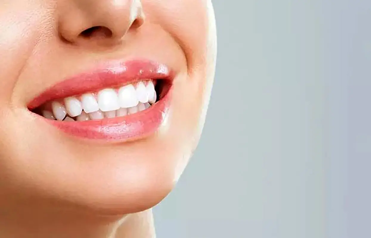  قیمت کامپوزیت دندان سال 1404 چقدر است؟ 