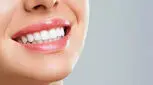  قیمت کامپوزیت دندان سال 1404 چقدر است؟ 