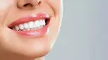 قیمت کامپوزیت دندان سال 1404 چقدر است؟ 
