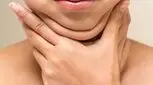 غبغب فقط نشانه چاقی نیست