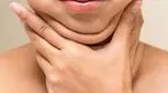 غبغب فقط نشانه چاقی نیست