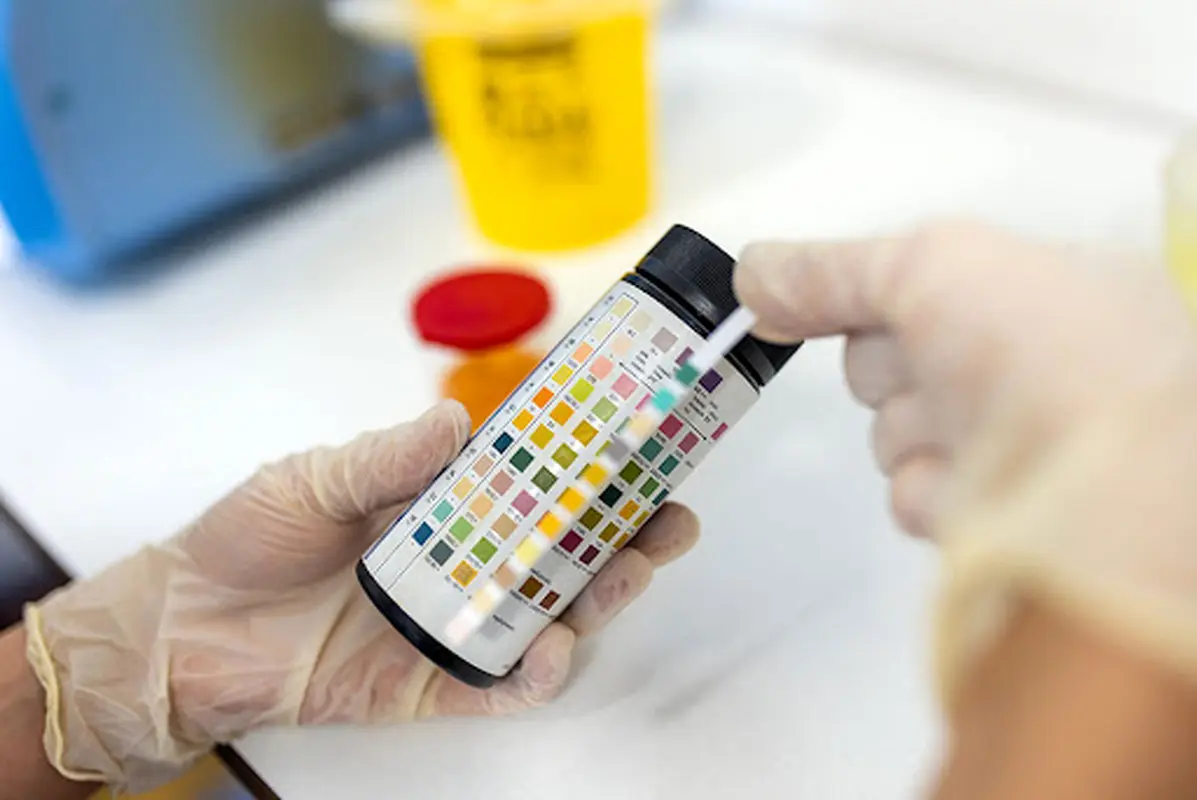 دفع پروتئین در بارداری: علل، عوارض و روش‌های درمان