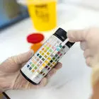 دفع پروتئین در بارداری: علل، عوارض و روش‌های درمان