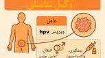 زگیل تناسلی چیست؟ انواع و علائم + جدیدترین روش های درمان