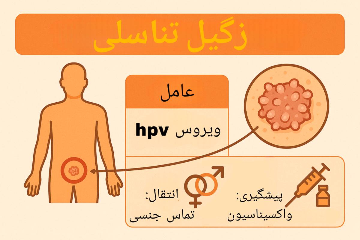 زگیل تناسلی چیست؟ انواع و علائم + جدیدترین روش های درمان
