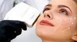 کاربردهای هایفوتراپی برای جوانسازی و زیبایی پوست صورت و بدن
