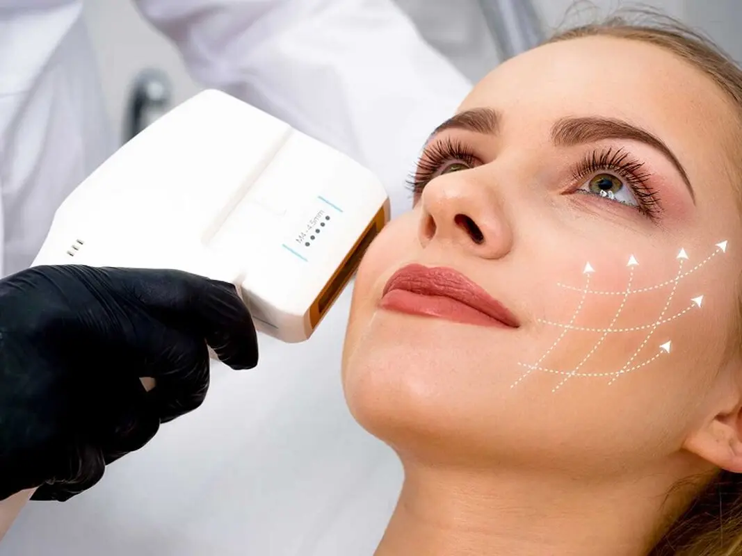 کاربردهای هایفوتراپی برای جوانسازی و زیبایی پوست صورت و بدن
