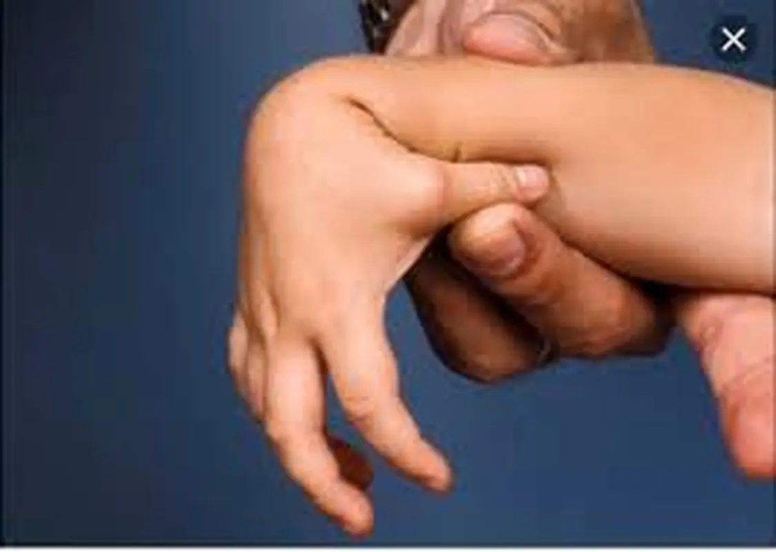 خم شدن زیاد انگشتان را به حساب انعطاف بدن نگذارید