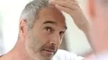 دلیل سفیدشدن موی سر چیست؟/ از استرس و ژنتیک گرفته تا کمبود ویتامین و بیماری