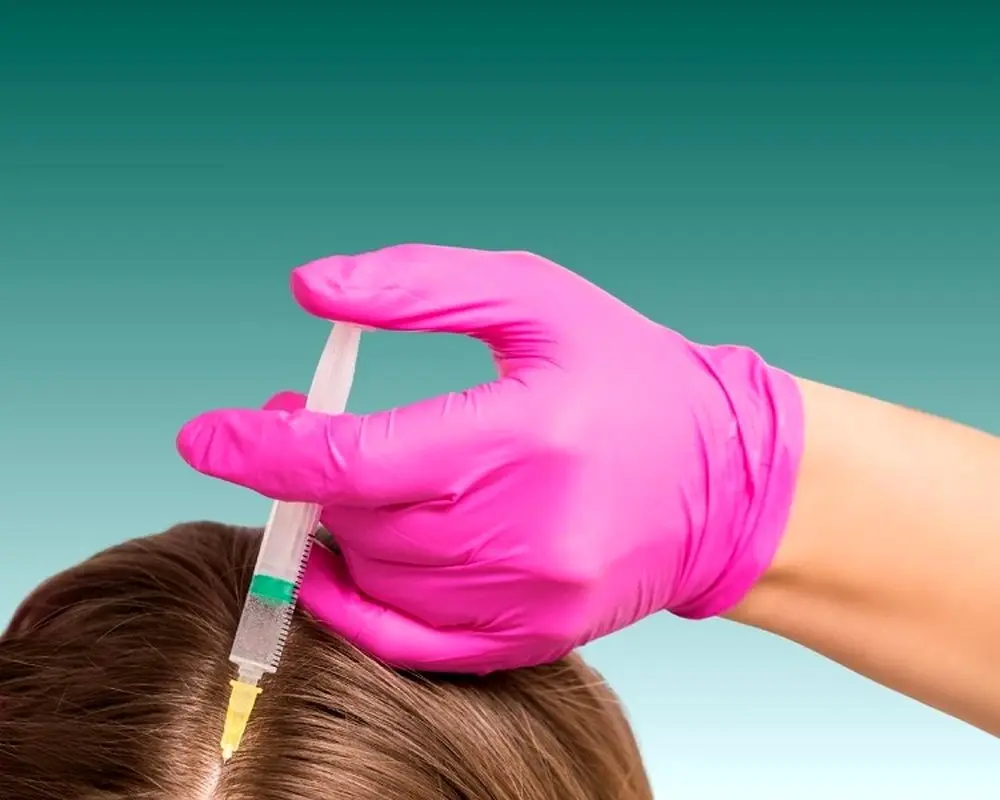 مزو مو یا هیر فیلر، شما کدام را می پسندید؟