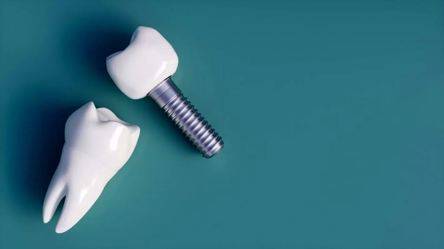 ایمپلنت کره ای بهتر است یا آمریکایی؟