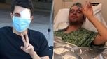 پیوند سلول‌های بنیادی به چشم نابینا نور دوباره بخشید
