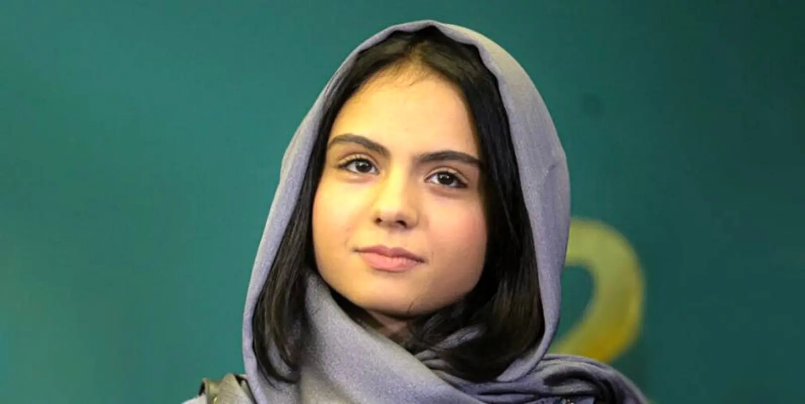 استایل هنرپیشه ای که با زخم کاری مشهور شد (عکس)