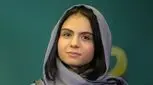 استایل هنرپیشه ای که با زخم کاری مشهور شد (عکس)
