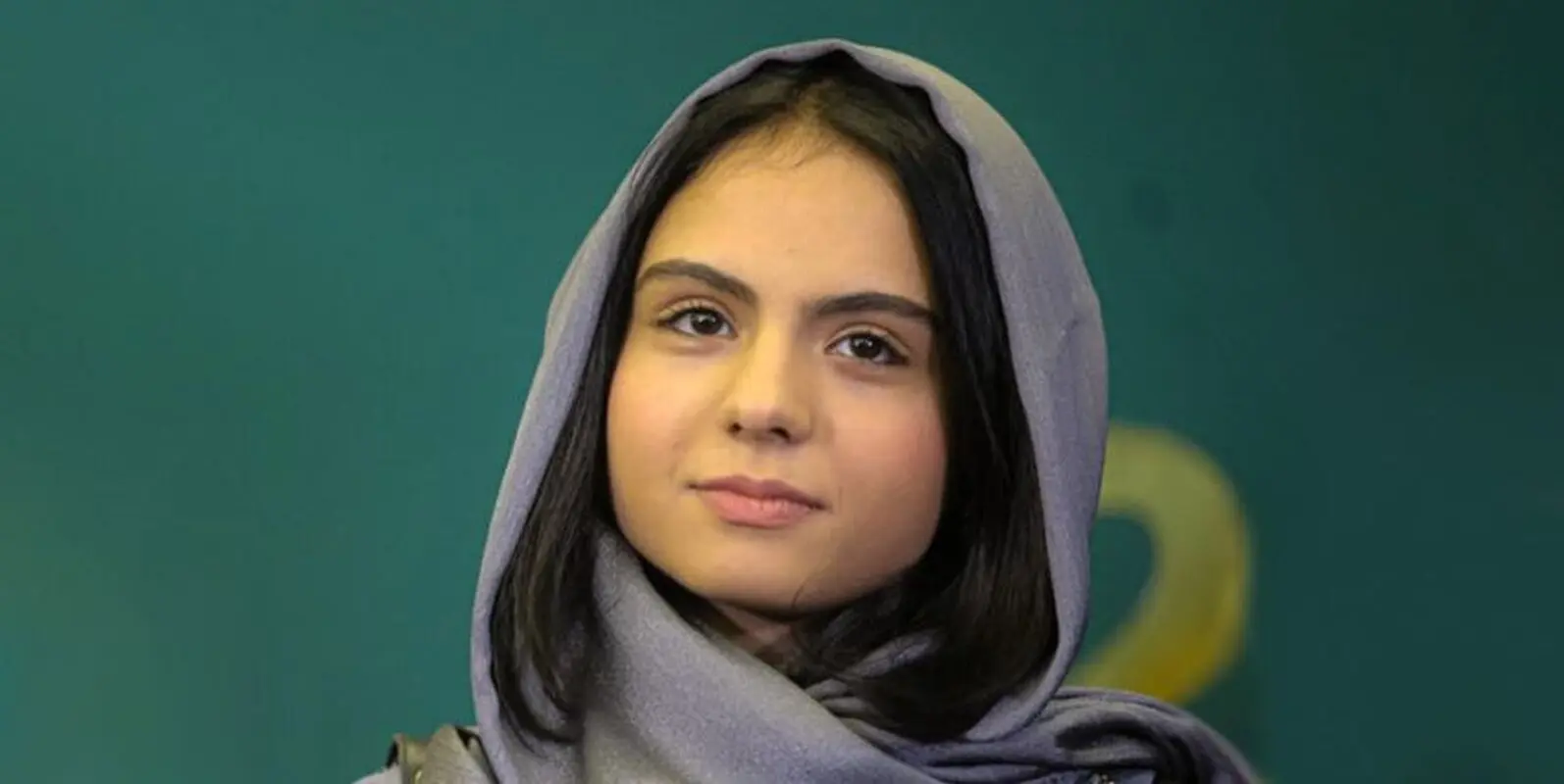 استایل هنرپیشه ای که با زخم کاری مشهور شد (عکس)