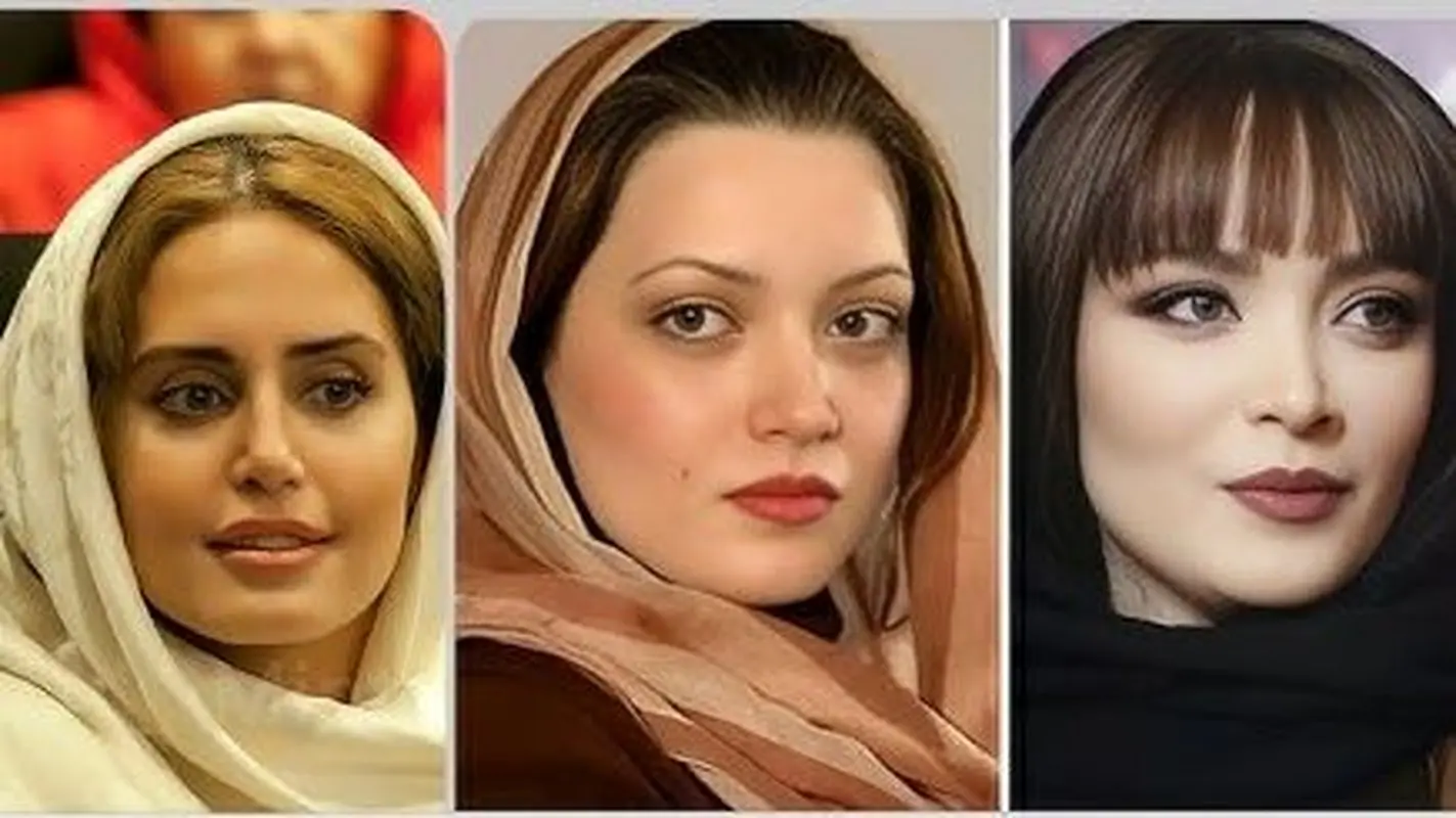 تغییر چهره عجیب بازیگران زن ایرانی بعد از عمل‌های زیبایی؛ از سحر دولتشاهی تا نیوشا ضیغمی!