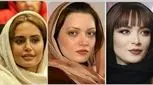 تغییر چهره عجیب بازیگران زن ایرانی بعد از عمل‌های زیبایی؛ از سحر دولتشاهی تا نیوشا ضیغمی!
