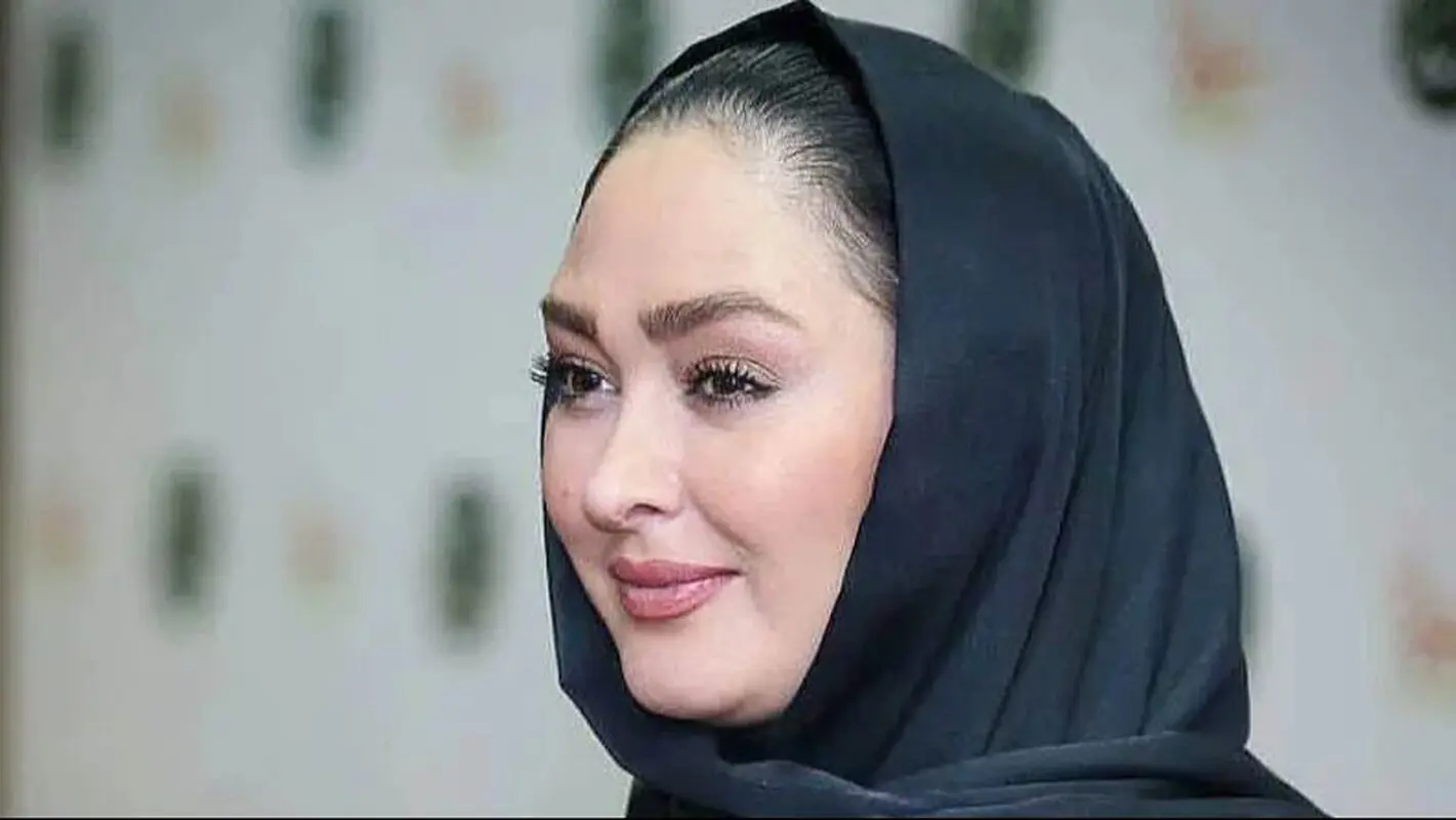تغییر چهره شوکه کننده الهام حمیدی بعد از کاشت ابرو / آسنات زیر و رو شد !