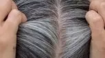 علت سفید شدن موها در جوانی چیست؟ پیشگیری از موی سفید در جوانی