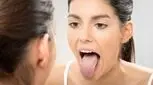 شاید کلید کاهش وزن در زبان نهفته باشد