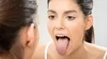 شاید کلید کاهش وزن در زبان نهفته باشد